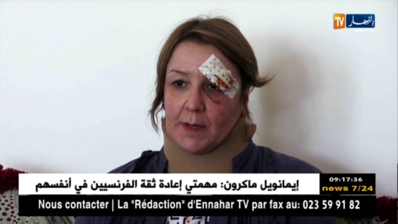 أستاذة في مادة اللغة الفرنسية تتعرض للضرب من طرف تلميذ