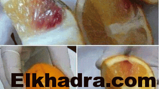 La légende des oranges contaminées au sida en Algérie 1