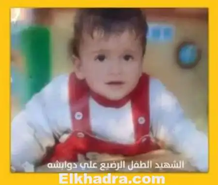 المستوطنون الصهاينة يحرقون صبيا فلسطينيا بنابلس