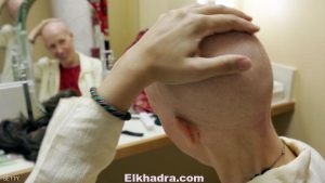 نصيحة ليحمي الخاضعون للعلاج الكيماوي شعر رأسهم 1
