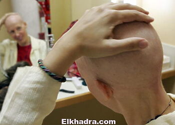 SAN FRANCISCO - AUGUST 17:  Breast cancer patient Susanne Ostlund rubs her head before trying on a wig at the Friend to Friend store at the UCSF Comprehensive Cancer Center August 17, 2005 in San Francisco, California. The UCSF Comprehensive Cancer Center continues to use the latest research and technology to battle cancer and was recently rated 16th best cancer center in the nation by US News and World Report. (Photo by Justin Sullivan/Getty Images)