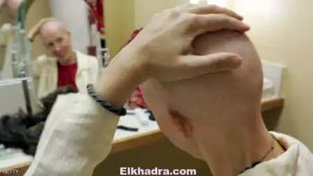 نصيحة ليحمي الخاضعون للعلاج الكيماوي شعر رأسهم