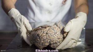 علماء يفوزون بأعلى جائزة بالعالم في أبحاث المخ 1