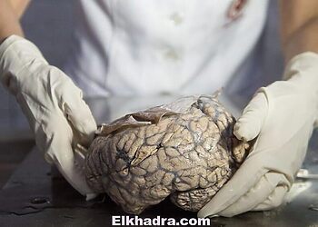 Doctor Diana Rivas displays a human brain on a working surface at the "Museum of Neuropathology" in Lima on November 16, 2016.
The "Museum of Neuropathology" at the Santo Toribio de Mogrovejo hospital bears a collection of 290 brains and offers an unusual journey by encephalic masses unrevealing the secrets of the most complex organ of the human body. / AFP / ERNESTO BENAVIDES        (Photo credit should read ERNESTO BENAVIDES/AFP/Getty Images)