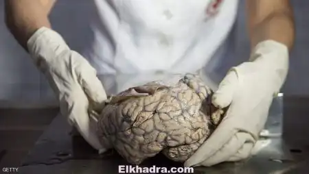 علماء يفوزون بأعلى جائزة بالعالم في أبحاث المخ