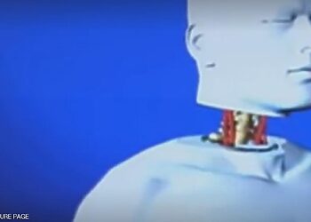 تحديد موعد أول جراحة لزراعة رأس في العالم 7