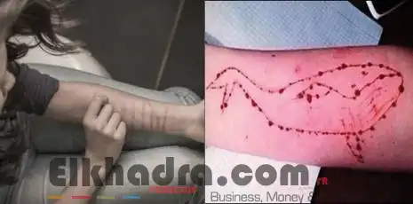 La baleine bleue fait des victimes à Mascara