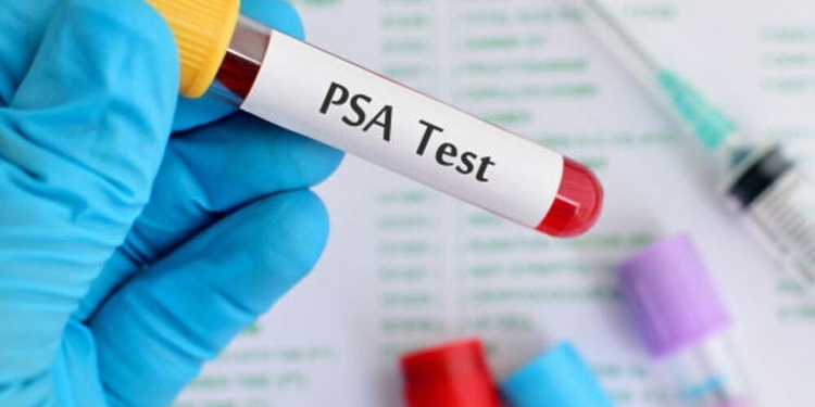 Cancer de la prostate : le dépistage individuel recommandé pour détecter la maladie 1