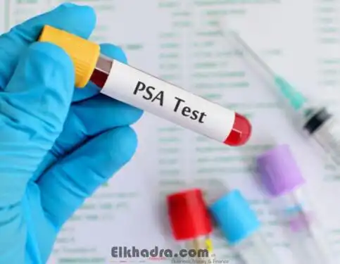 Cancer de la prostate : le dépistage individuel recommandé pour détecter la maladie