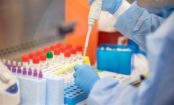 Coronavirus: 113 nouveaux cas et aucun décès ces dernières 24h en Algérie 1