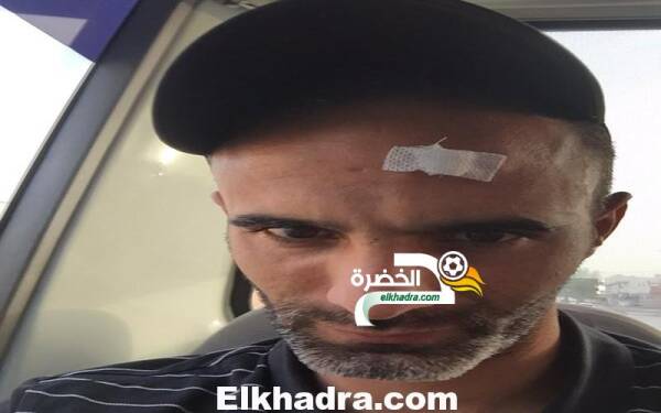 سيدريك يصاب بجروح على مستوى الرأس، بعد تعرّضه للرشق بالحجارة خلال مباراة شباب قسنطينة و شبيبة الساورة