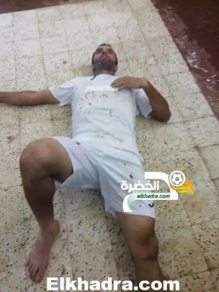 بالصور..  جرحي واصابات في مباراة شباب عين وسارة و  بني ثور