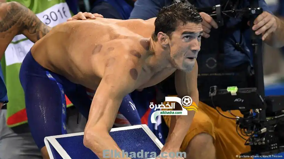 نجوم أميركا يستعينون بالحجامة النبوية لنيل ذهب الأولمبياد