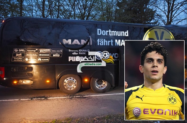 الإسباني مارك بارترا مدافع بوروسيا دورتموند يجري عملية جراحية بعد التفجيرات