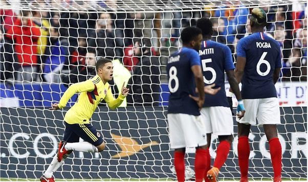 كولومبيا تفوز على فرنسا بثلاثية 1