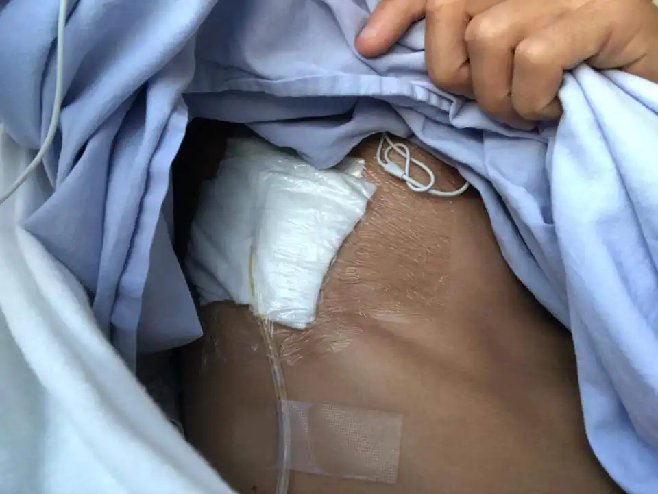 عملية جراحية تبعد هذه الموهبة الجزائرية لمدة 4 اسابيع !