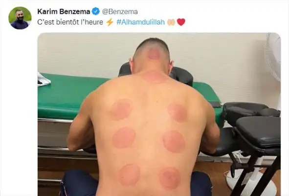كريم بنزيما يطمأن جماهير الميرنجي